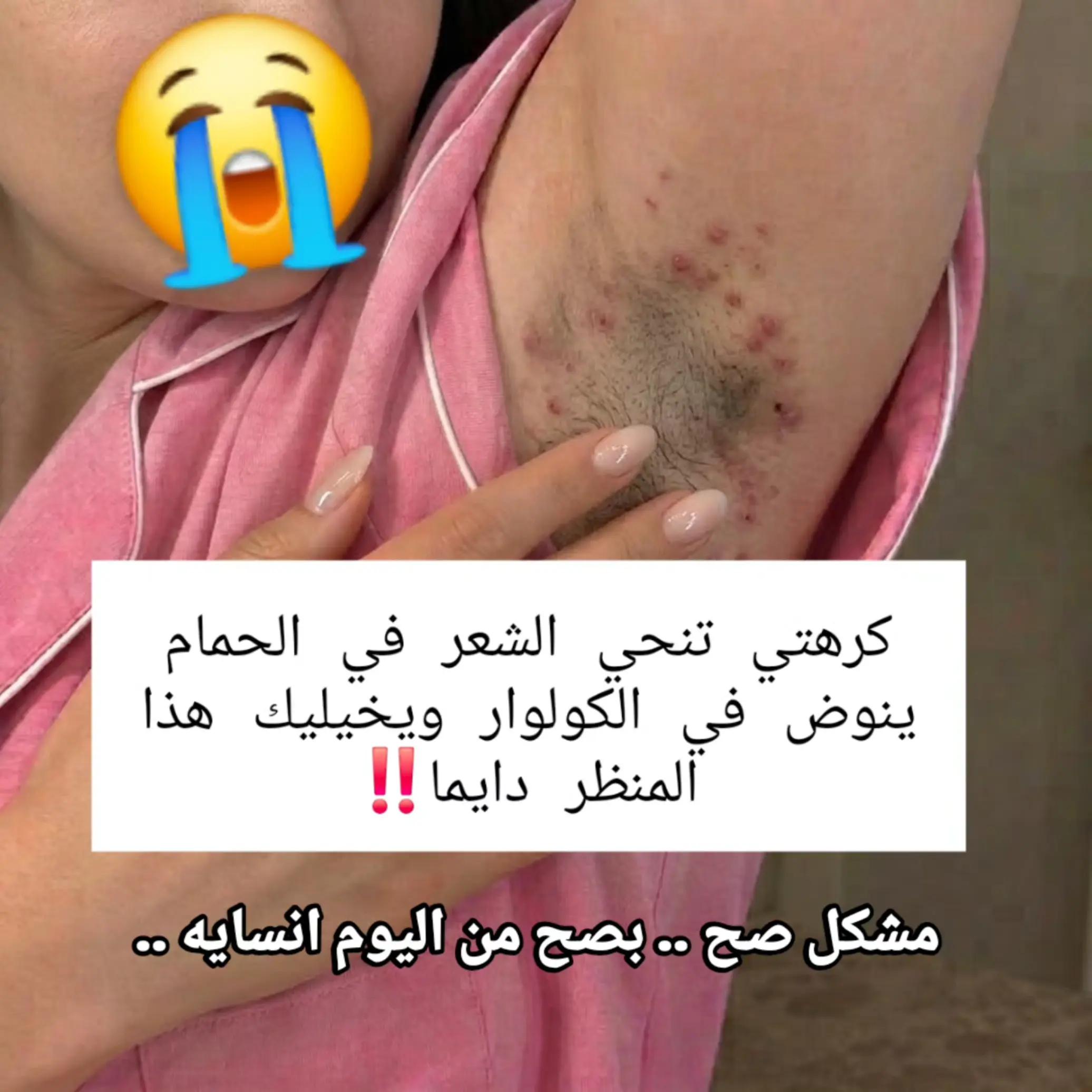 @جمالك وأنوثتك مع يزال🎀