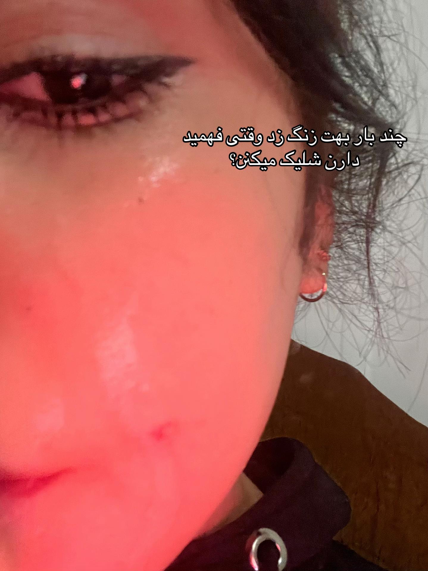 @Setareeh