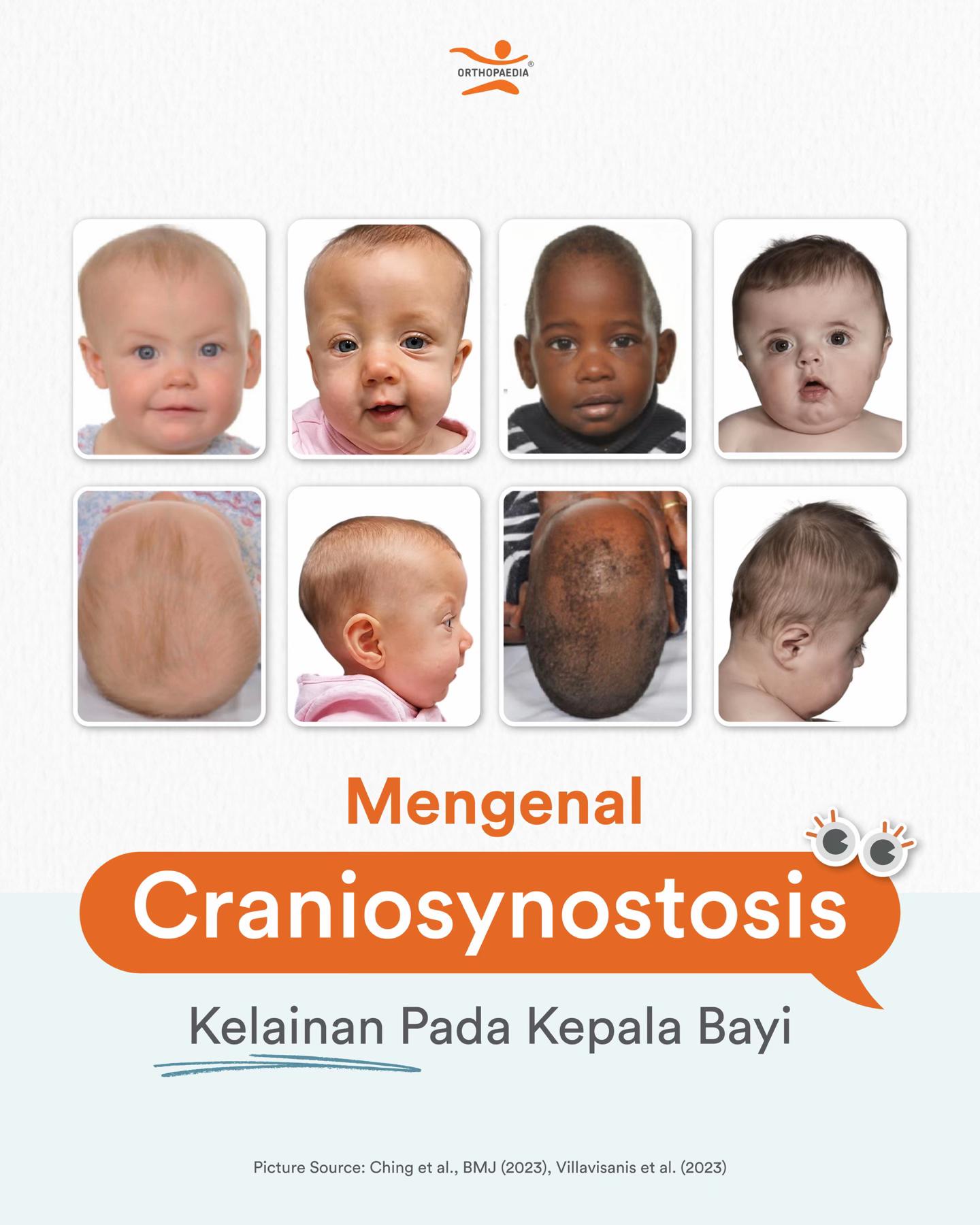 @Orthopaedia Indonesia