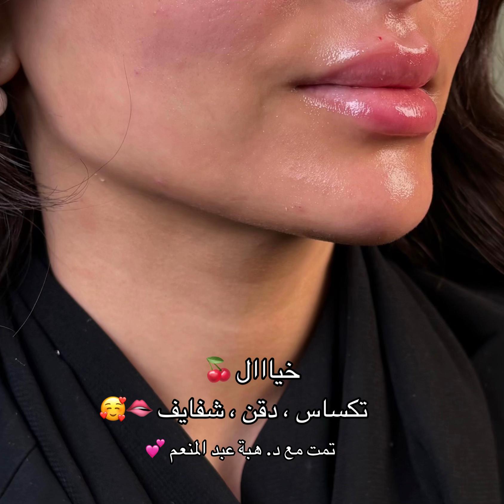 @مزدانه (فرع الملك عبدالله)