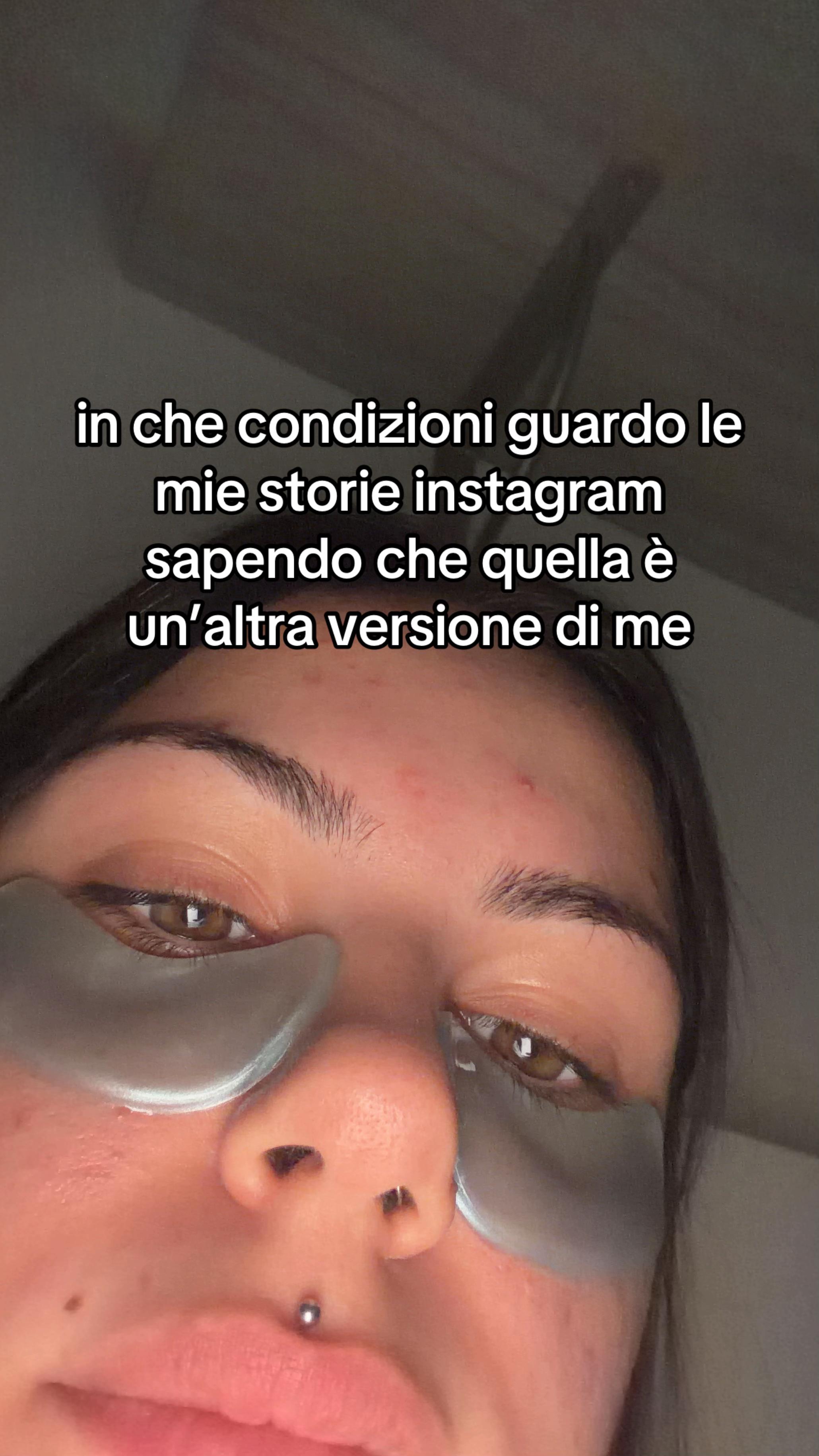 @ale