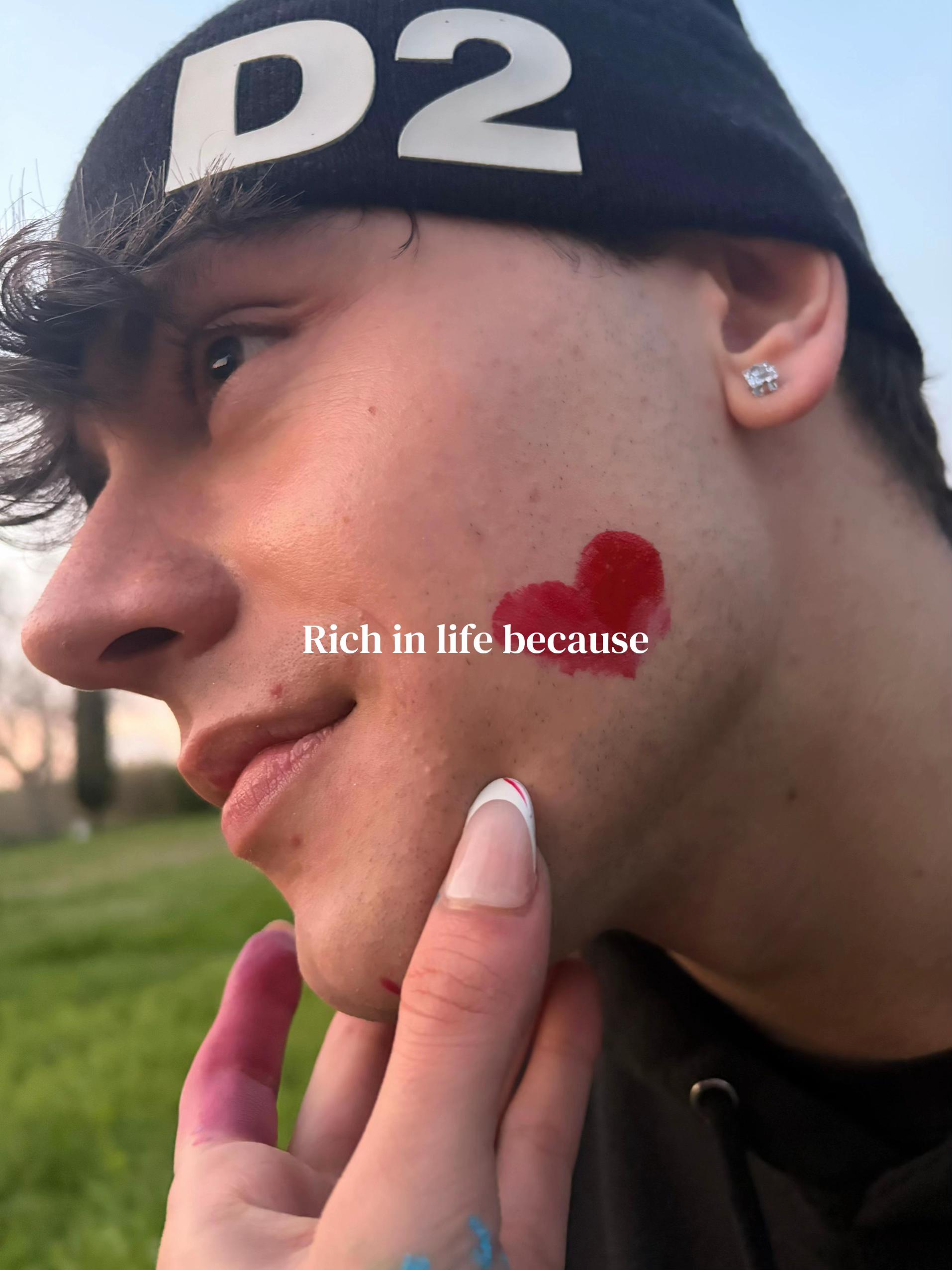 @Leo