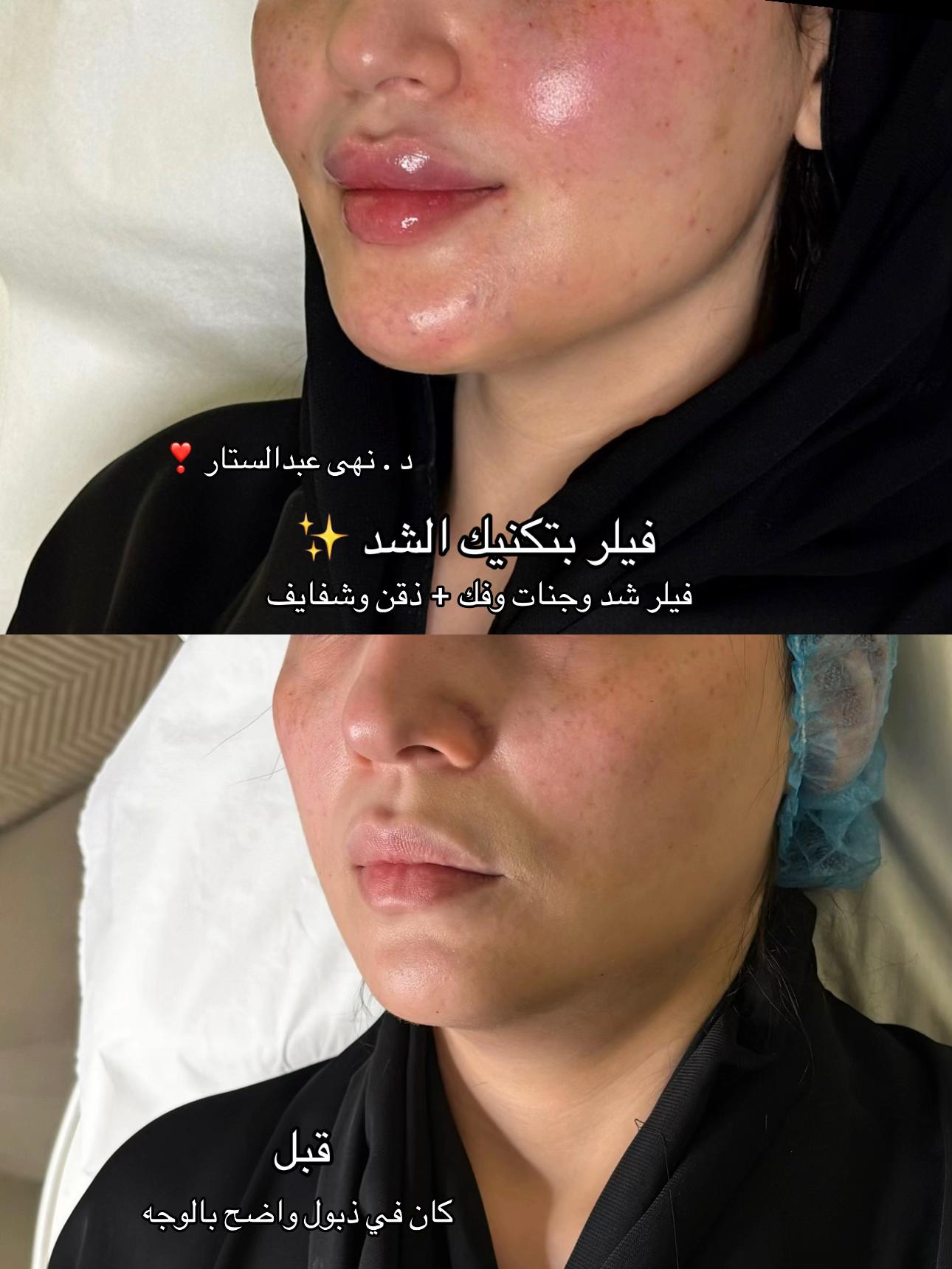 @مركز مزدانه 1 ( فرع الصحافه )