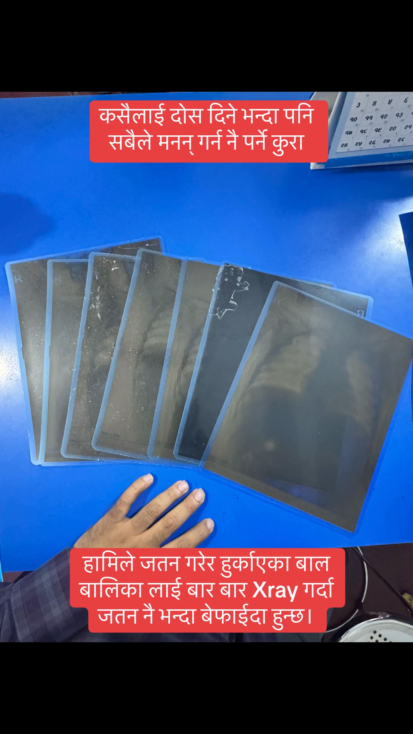 @Dr Jagat Jeevan Ghimire DM