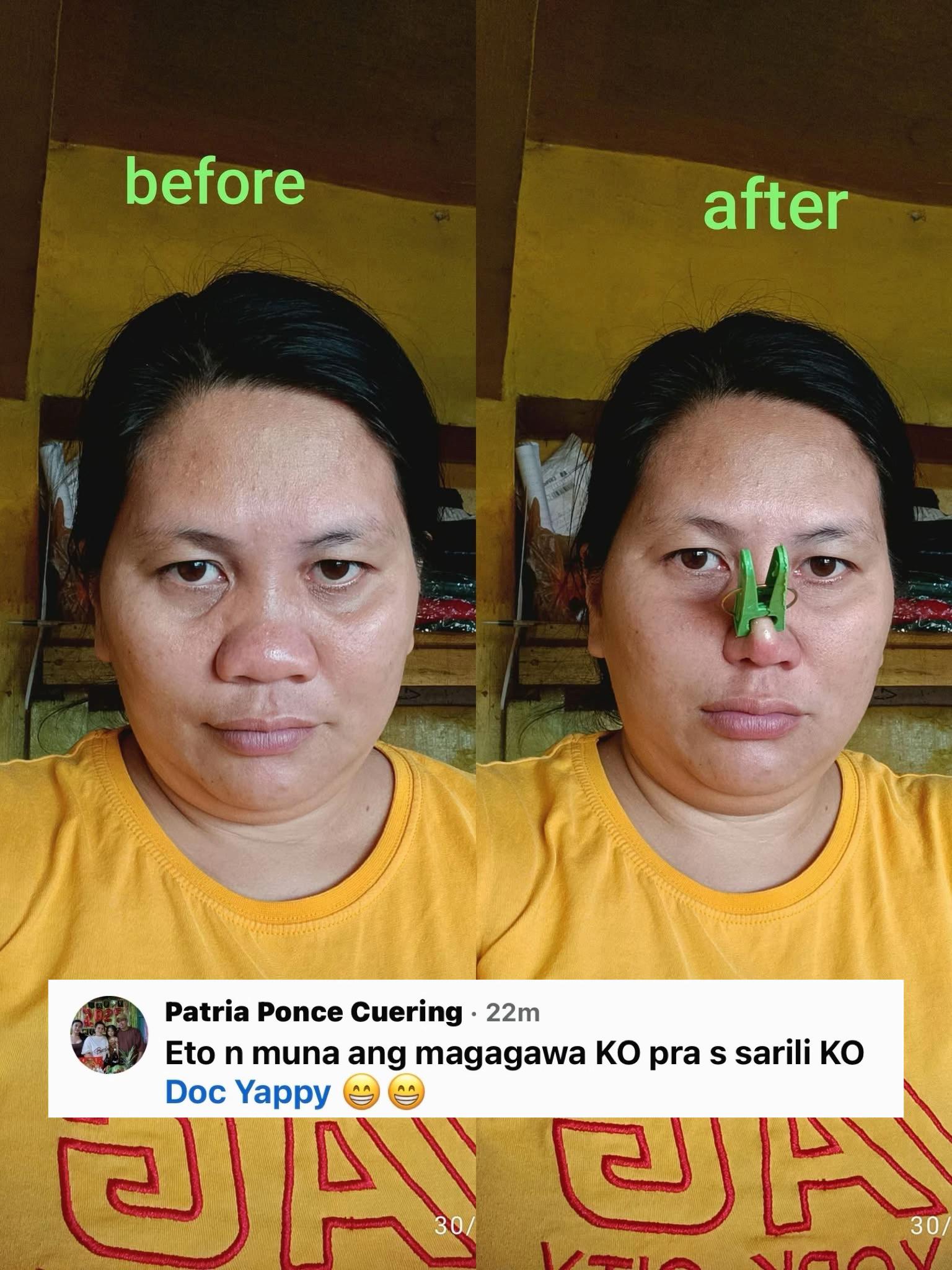 @Eric Yapjuangco, MD