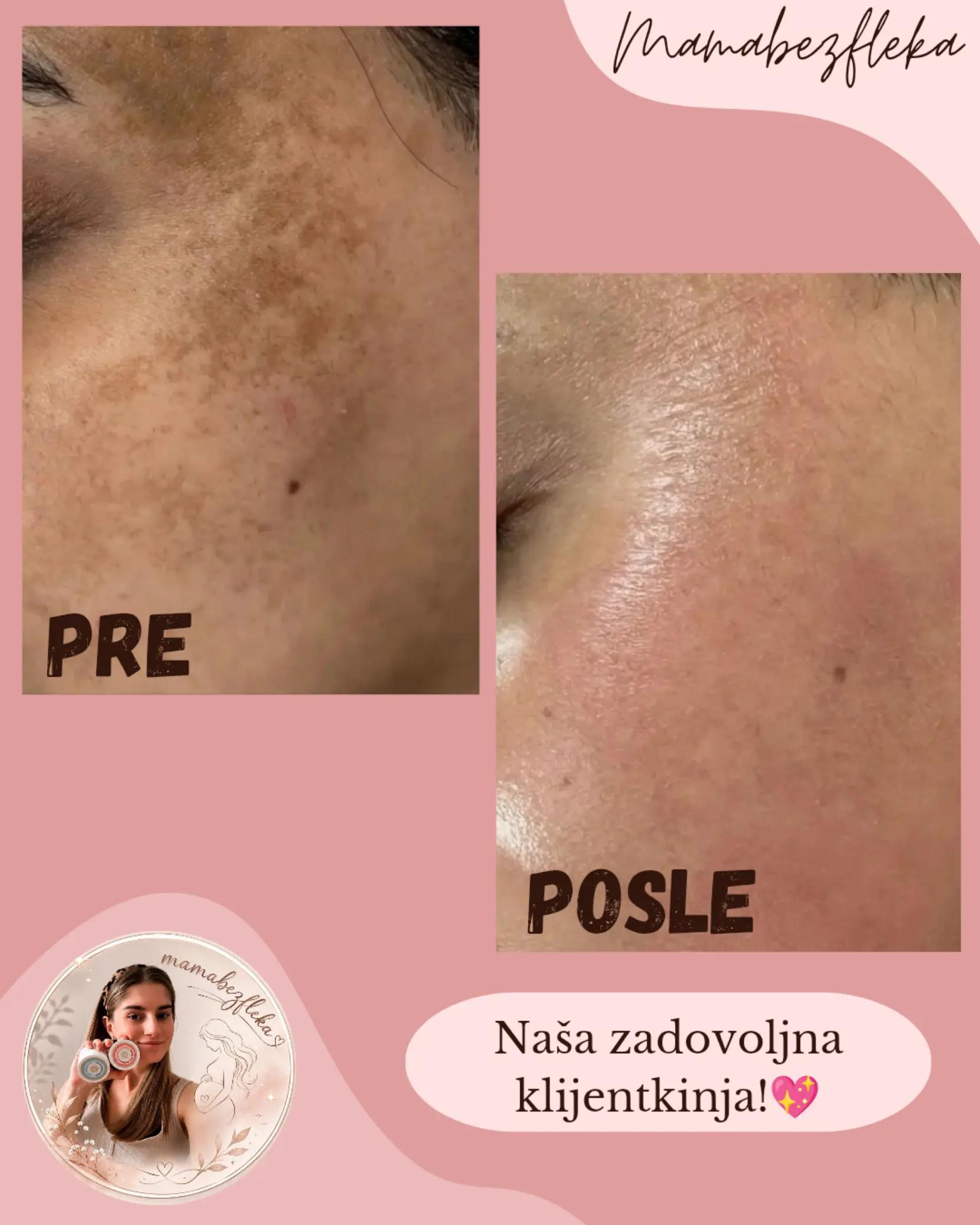@Mama bez fleka