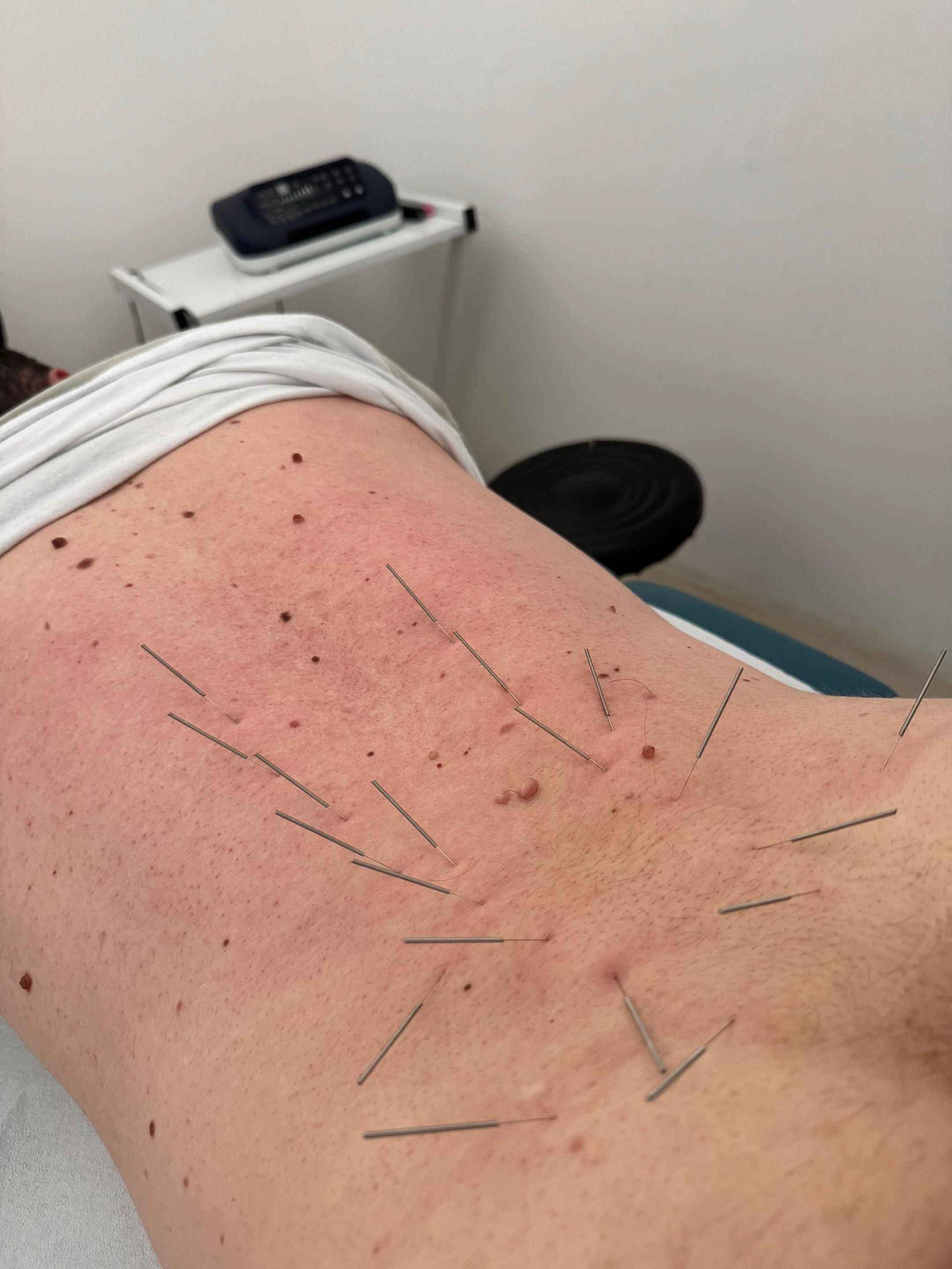 @FIZIOTERAPIA &ldquo;LUMI&rdquo;