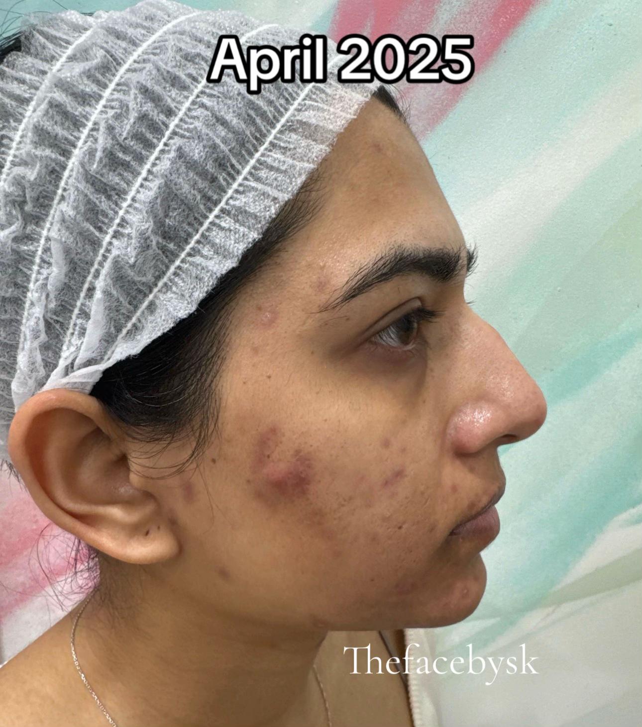 @The Facebysk