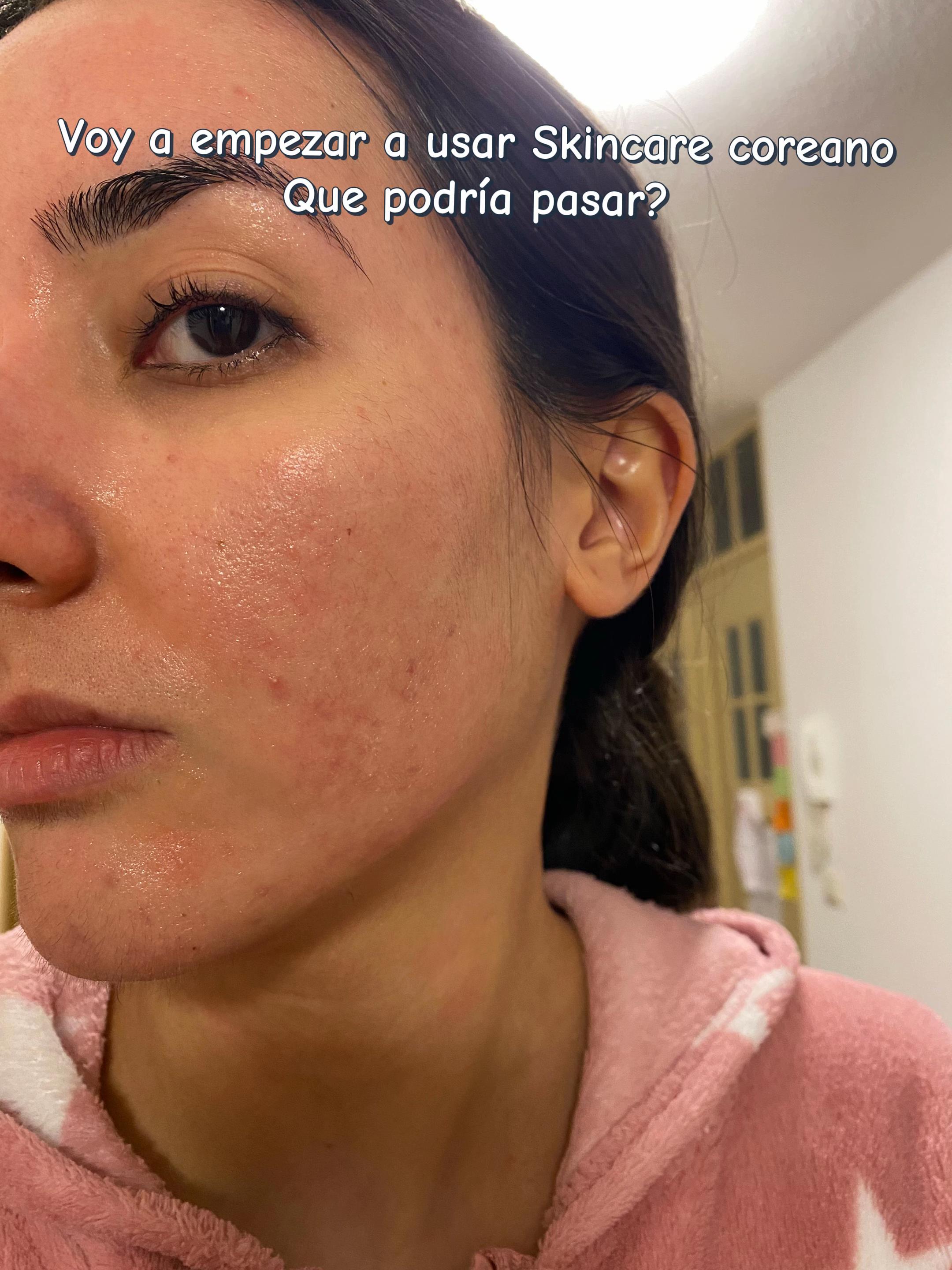 @MichelinaSkin