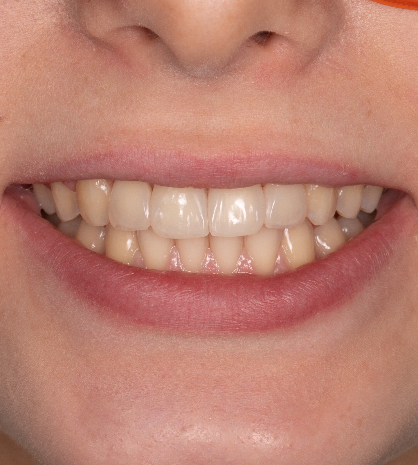 @Anna 🦷 dentystka