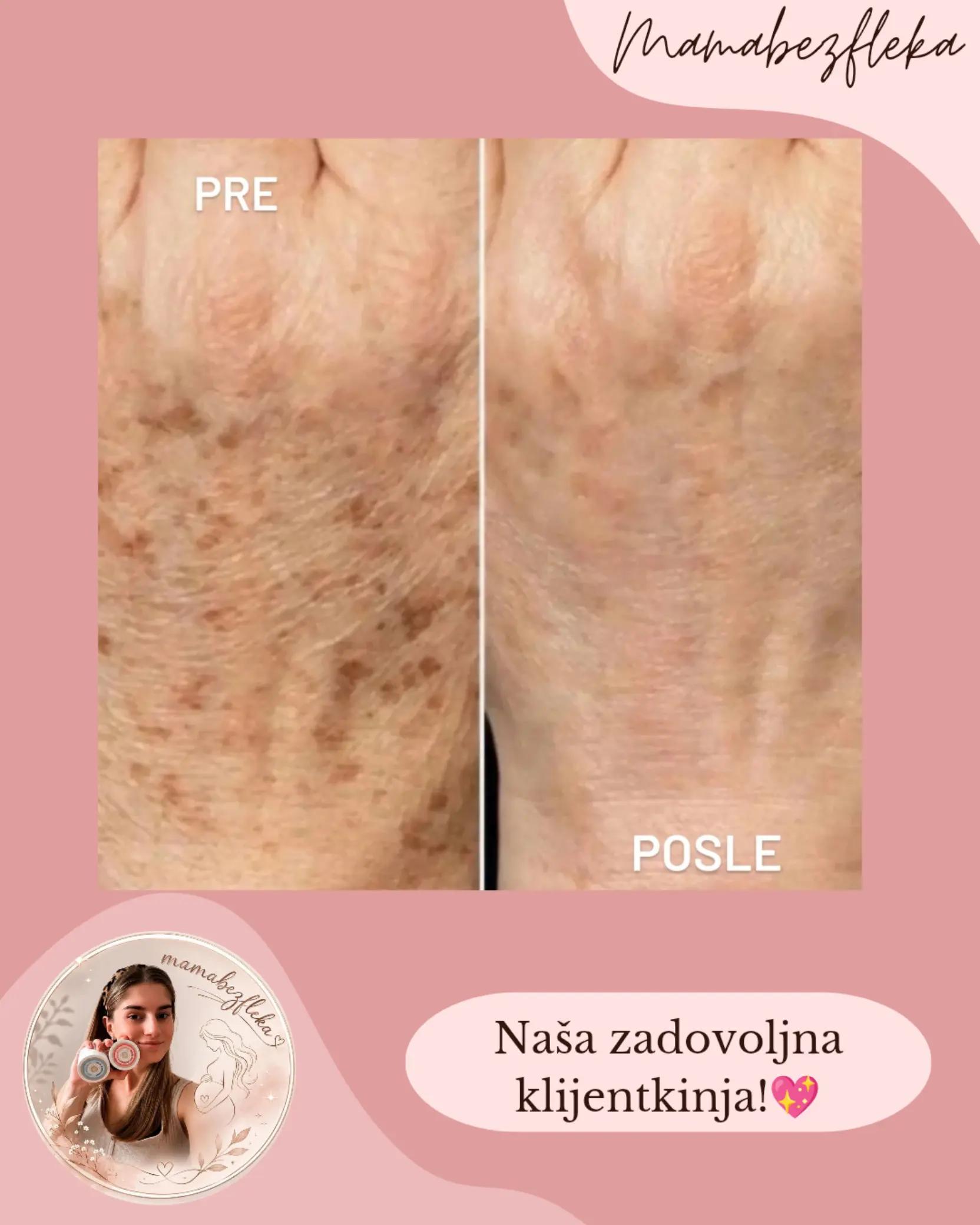 @Mama bez fleka