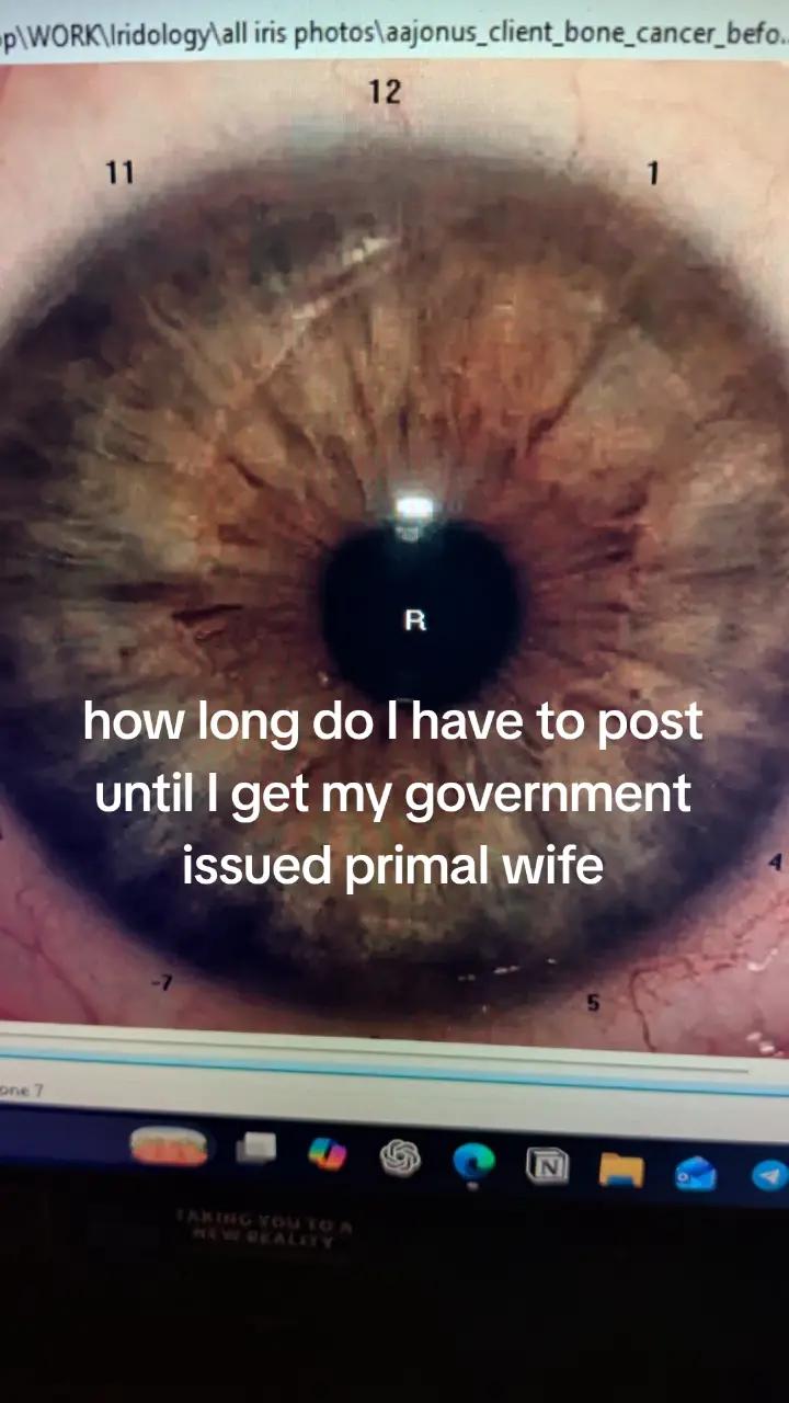 @Oliver | Aajonus' Iridology 👀