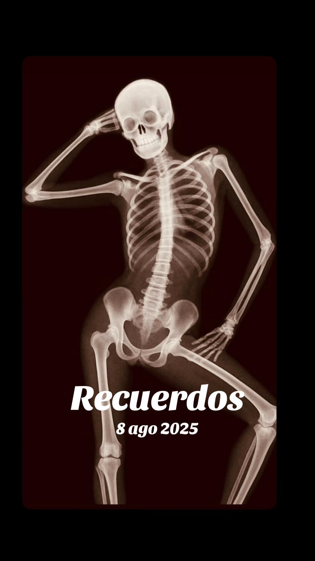 @Mi Yalorde