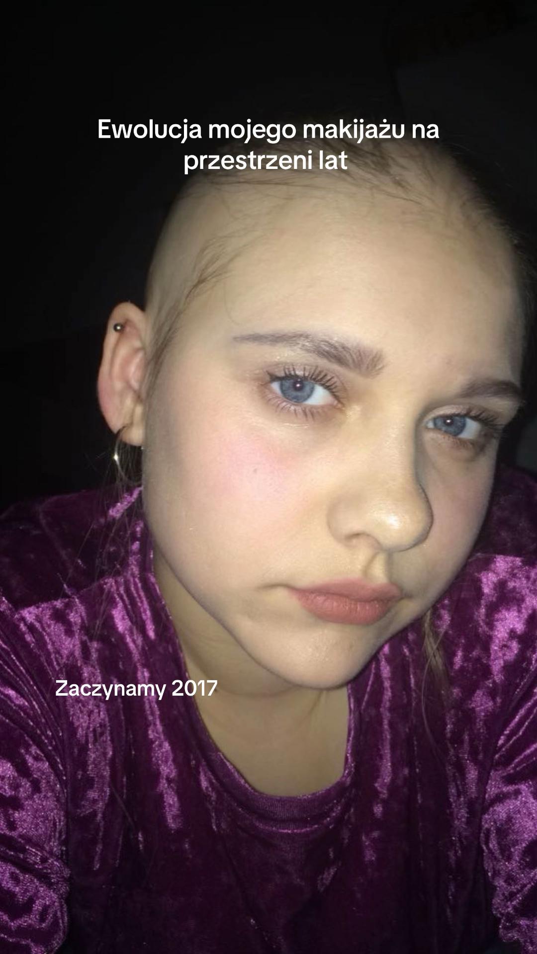 @Łysa Baba • Kinga