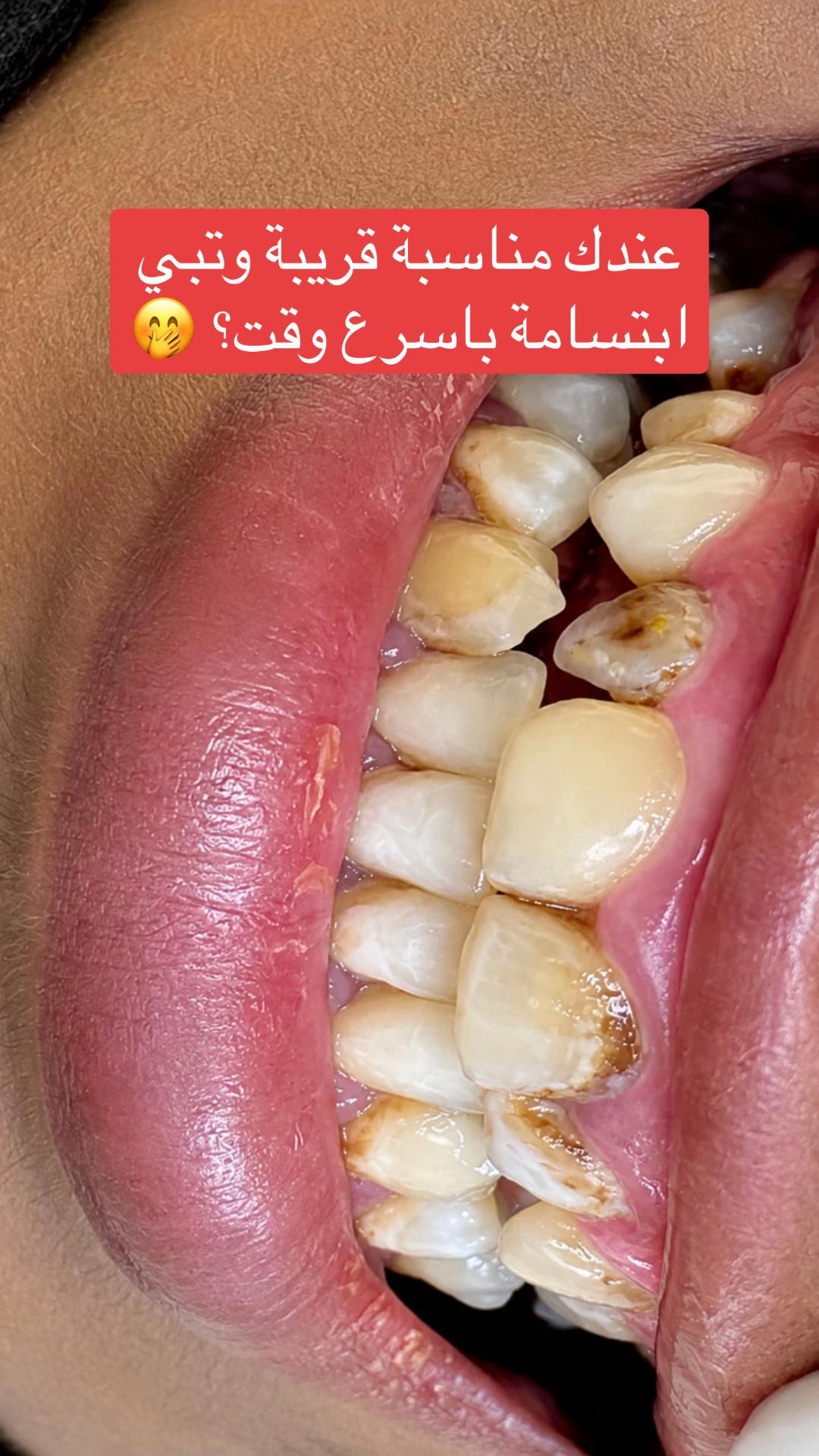 @عيادات بيور كلينك