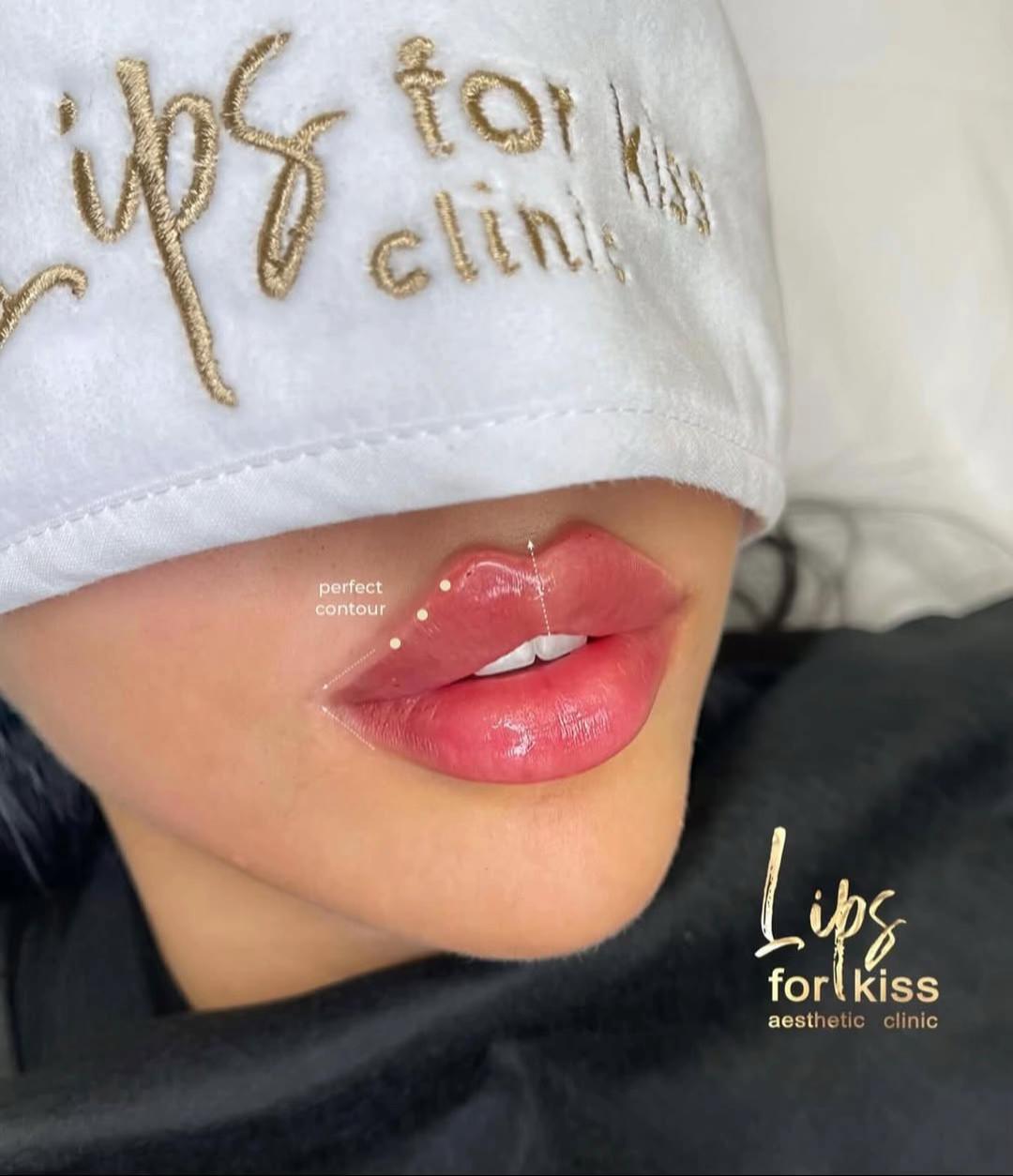 @Lips_for_kiss