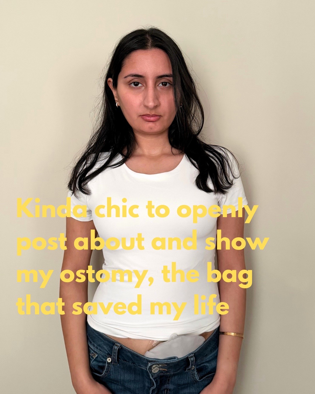 @ostomate