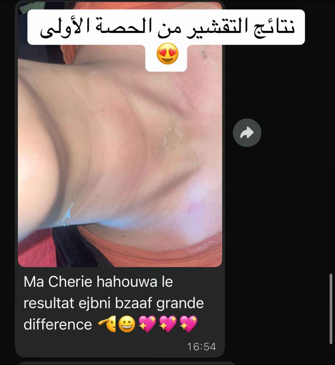 @esthesaraa