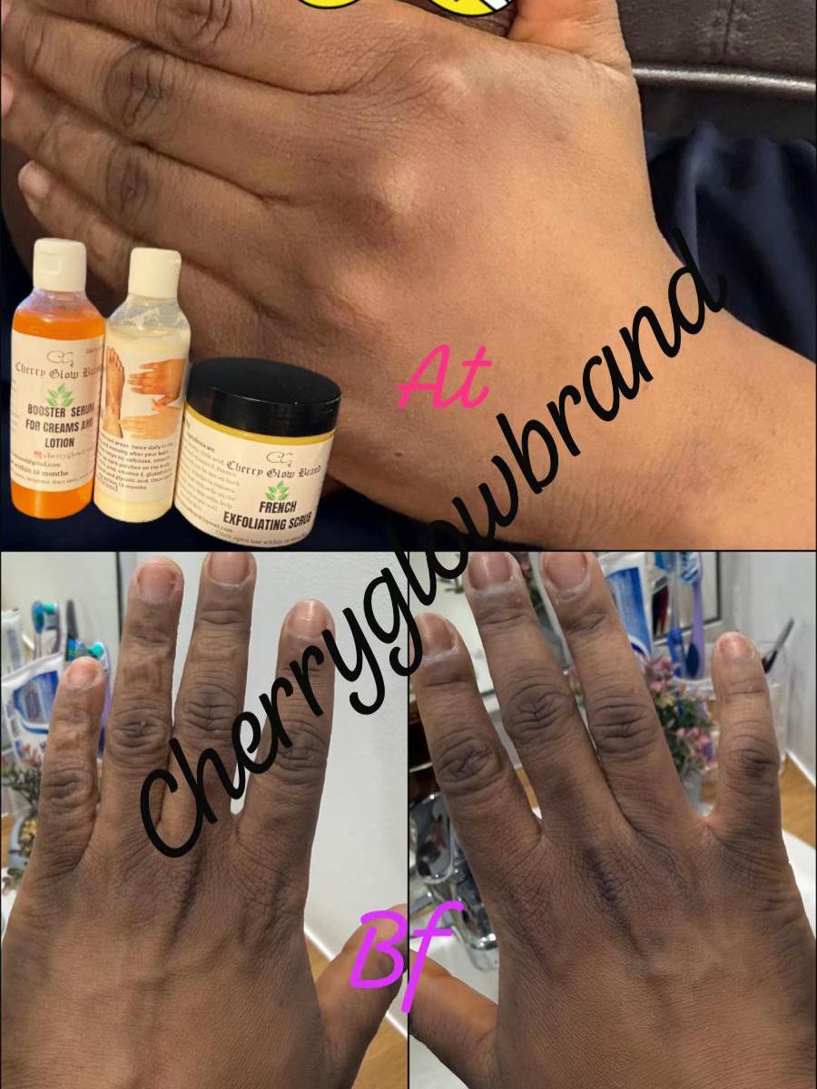@Cherryglowb🇨🇦🇺🇸🇨🇳🇨🇲