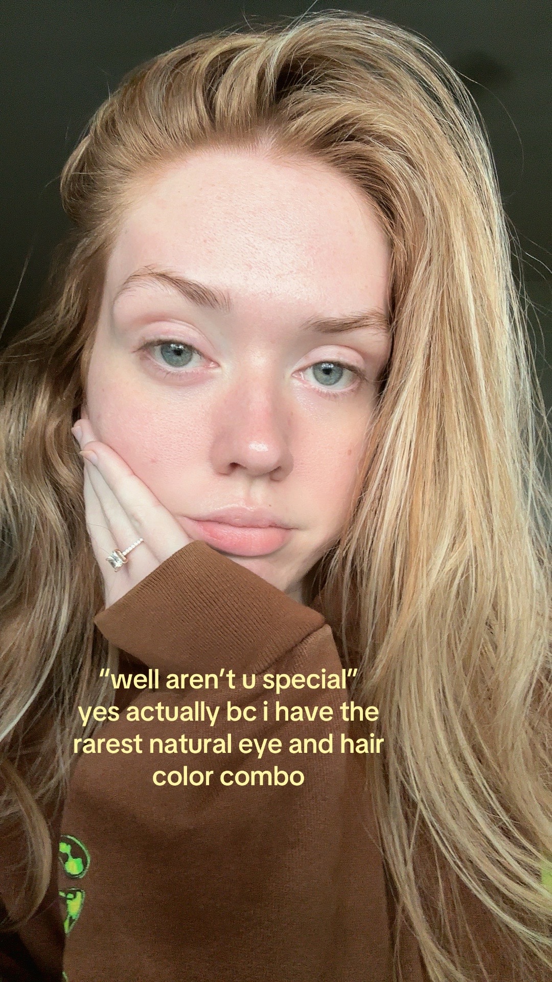 @abi