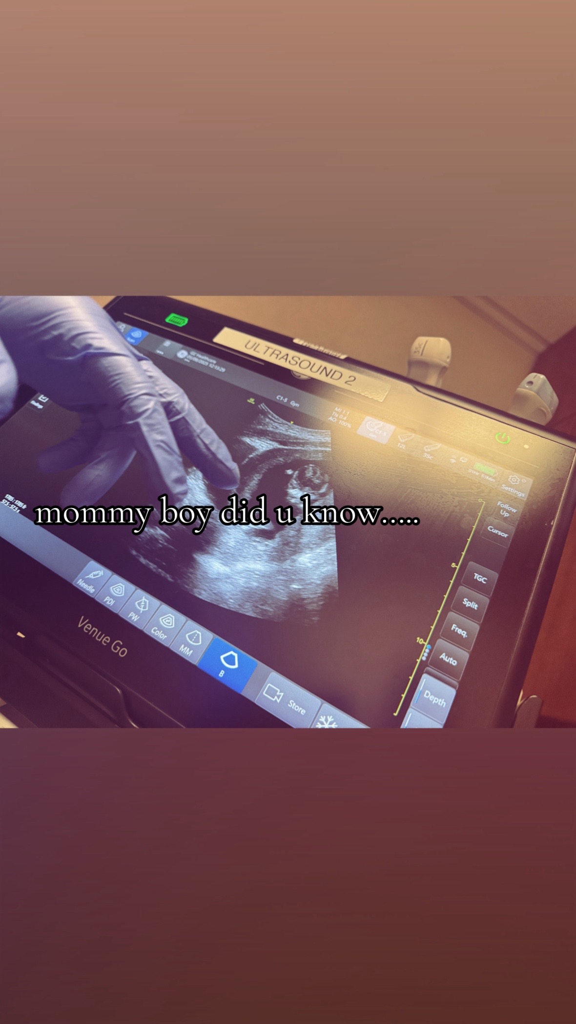 @ms.thicksumm