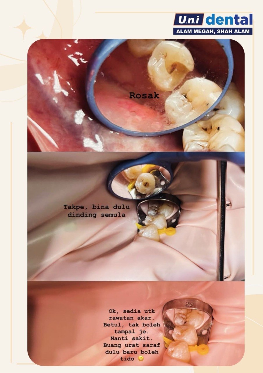 @Klinik UNI Dental Alam Megah