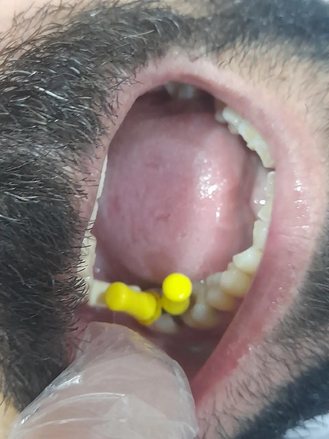 @Dr Adil khan 🦷🦷