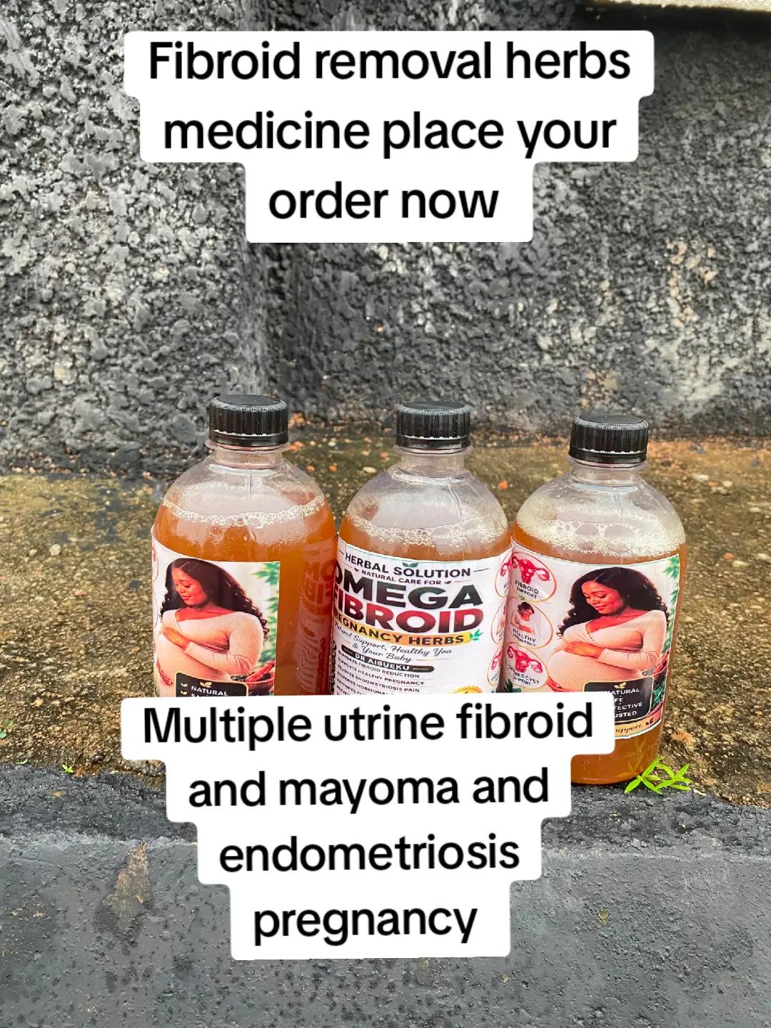 @omega fibroid removal herbs