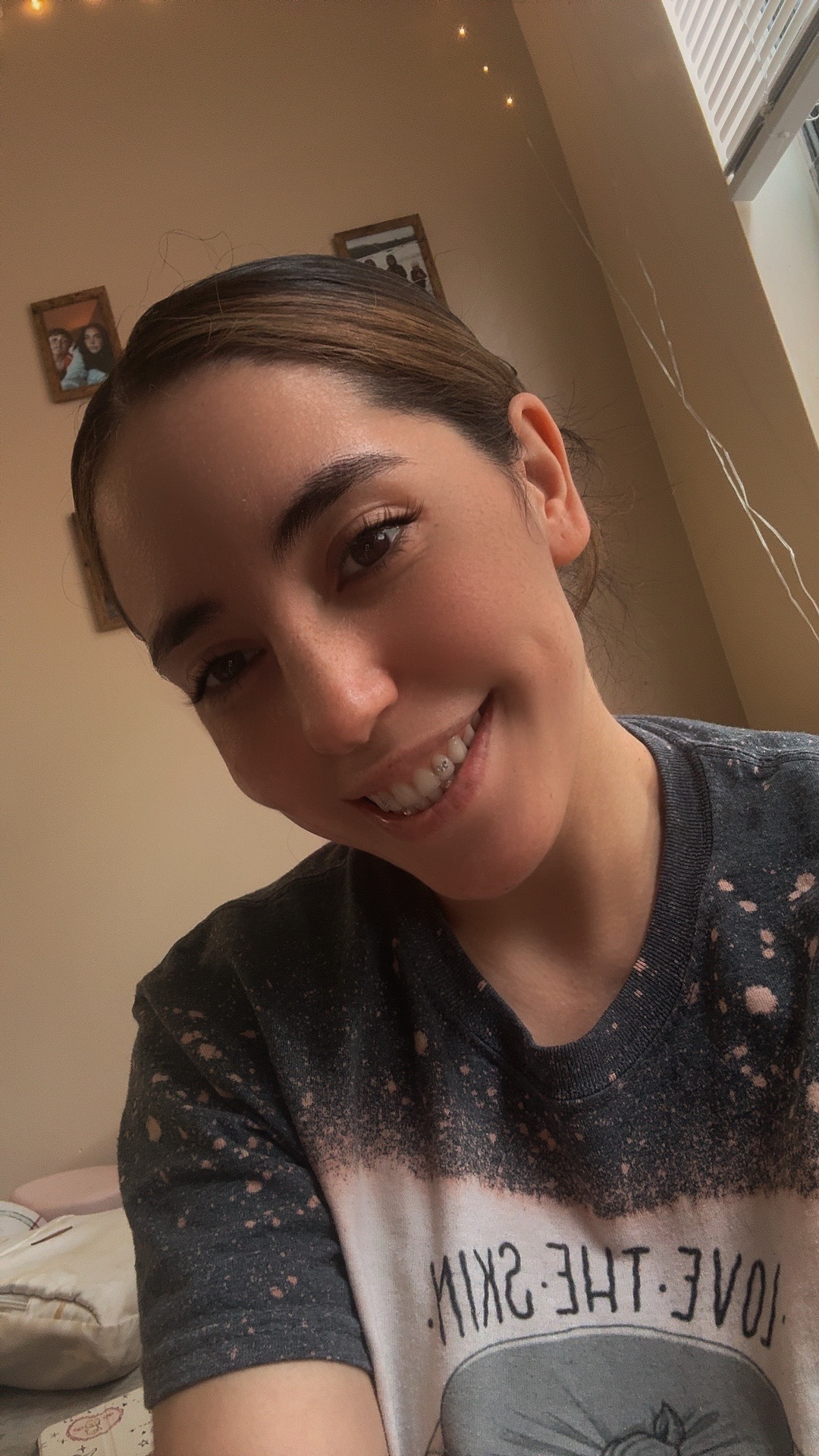 @Kiama 🎀💗🦷