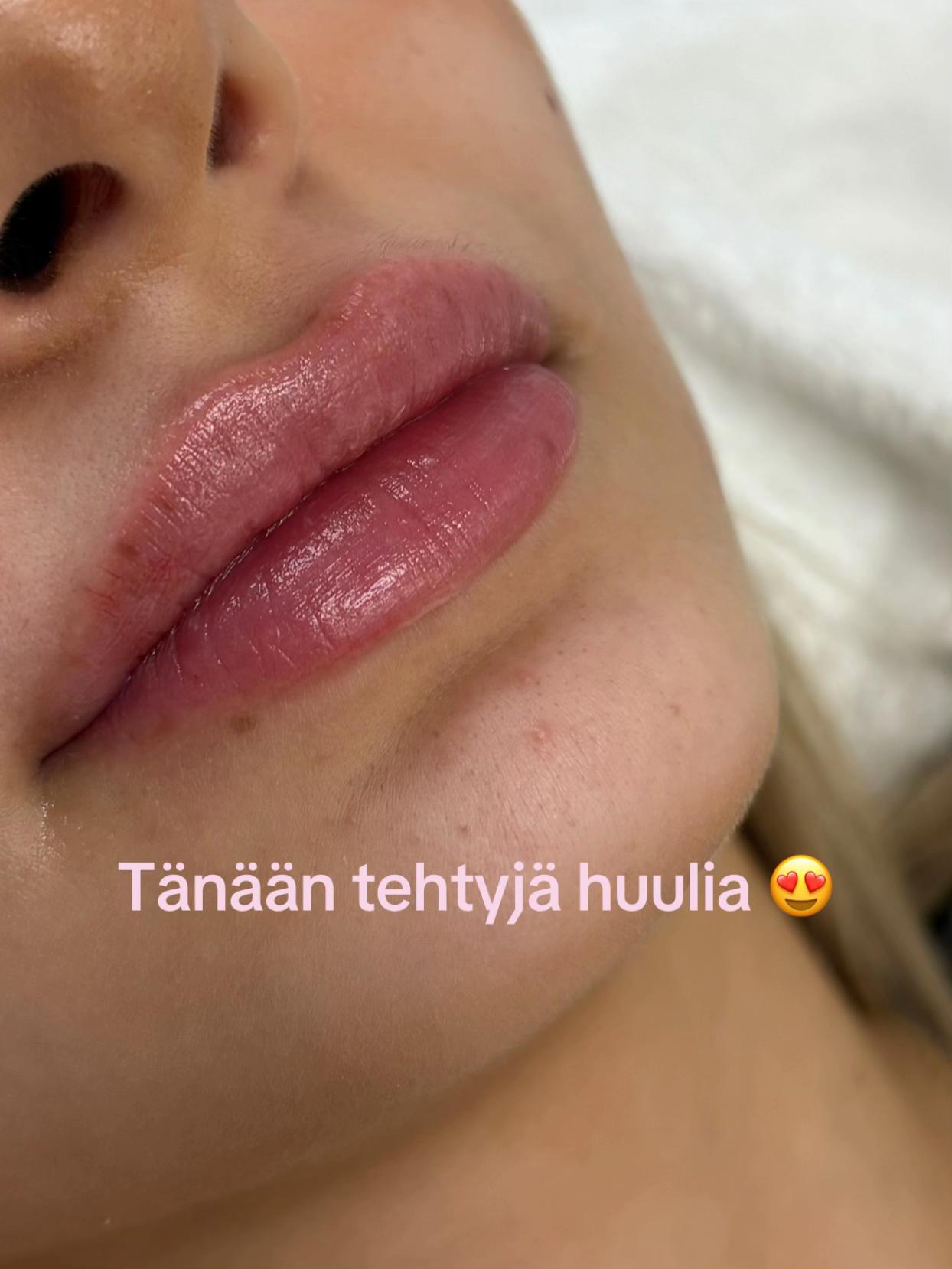 @Sairaanhoitaja Lotta 💉