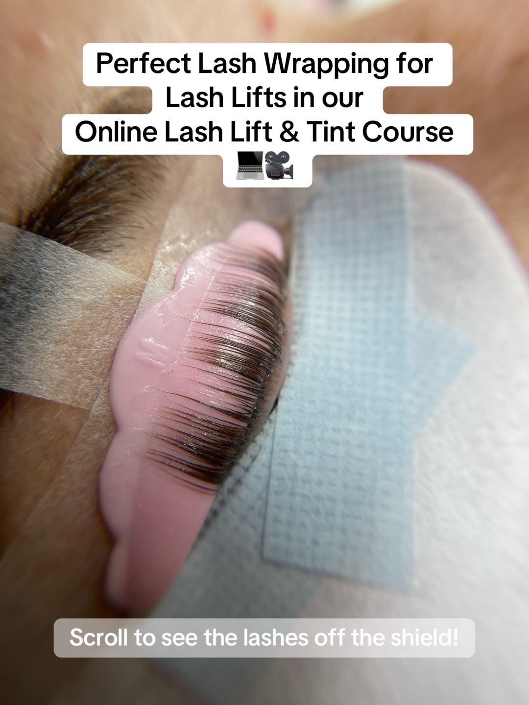 @Diandra | Teeth Whitening Tech