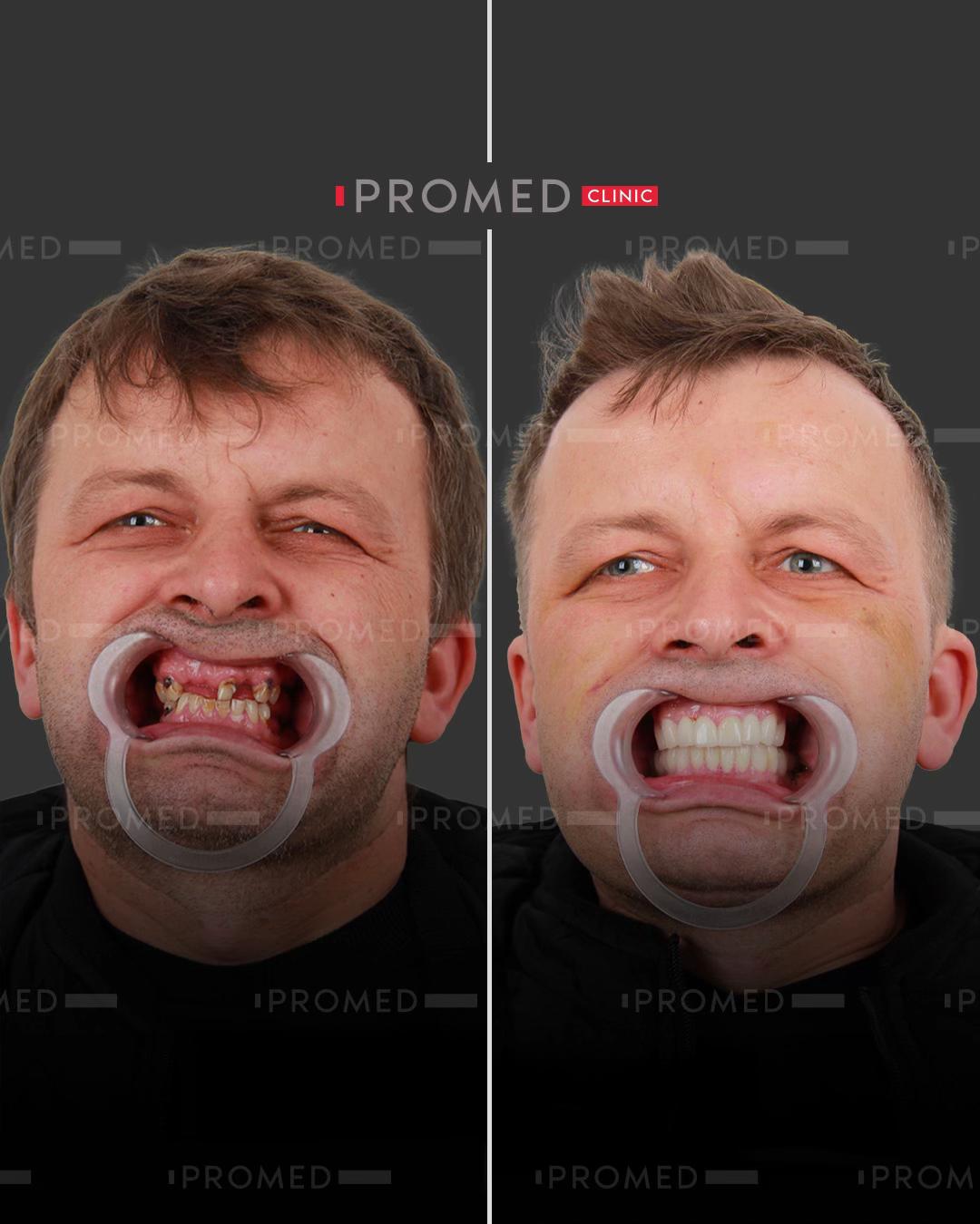 @promeddentalclinic