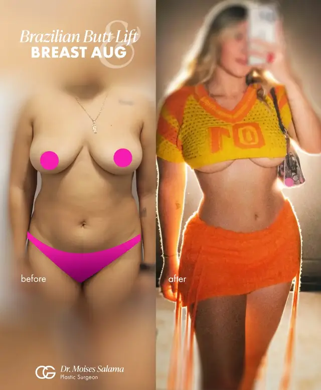 @CG Cosmetic Surgery | Miami