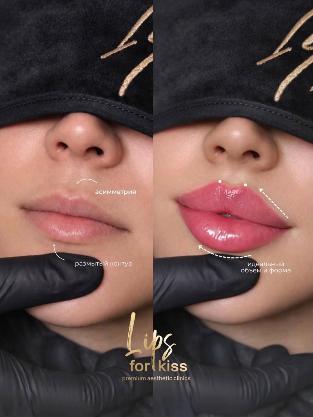 @Lips_for_kiss