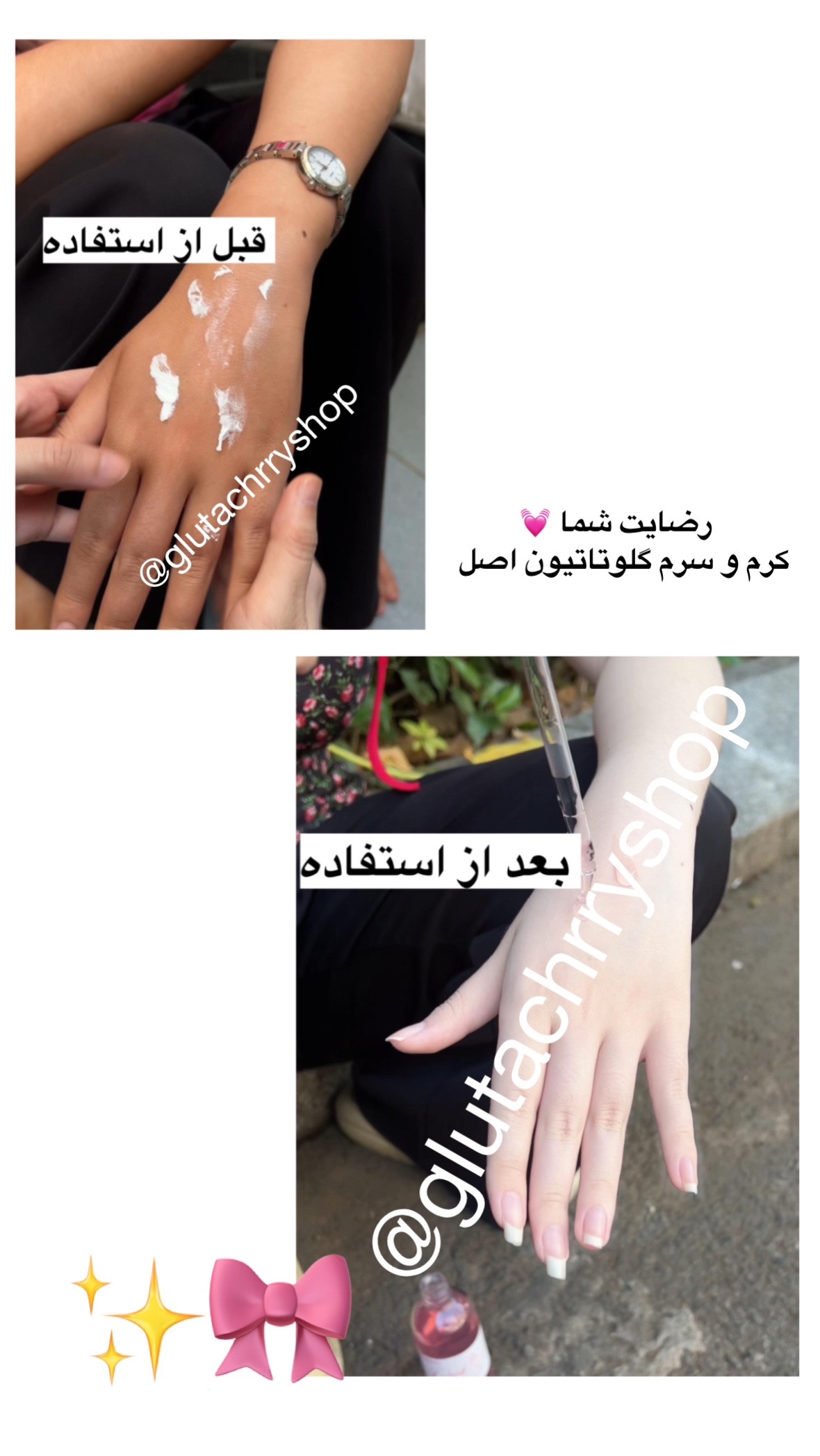 @گلوتاچری شاپ