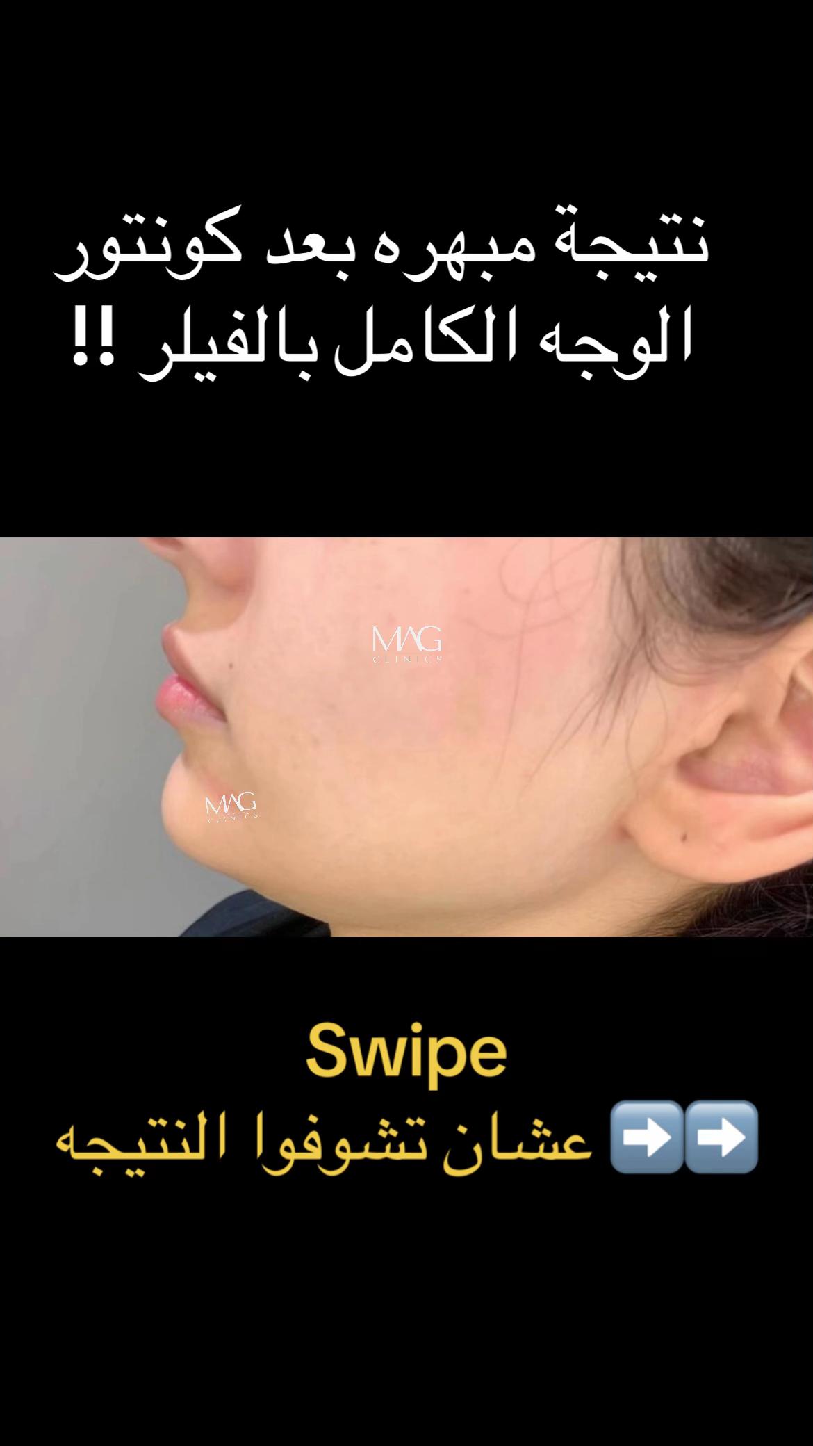 @Dr. Mohamed Abu El-Gheet