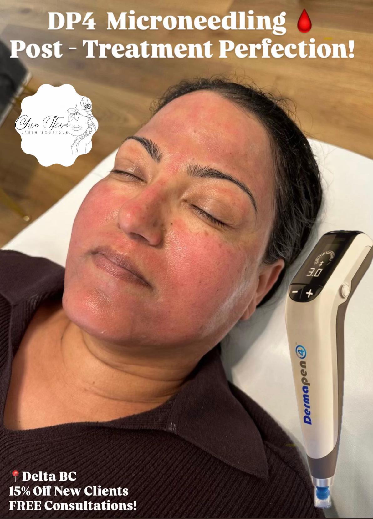 @Yris Skin Laser Boutique Delta