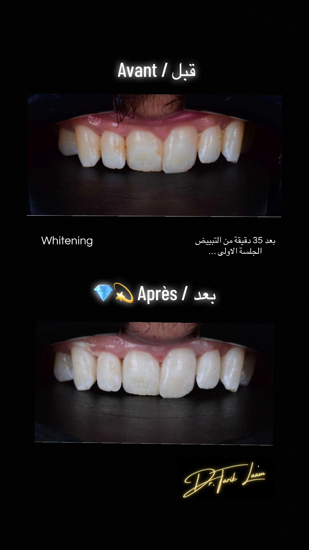 @Dr.tarik_laam