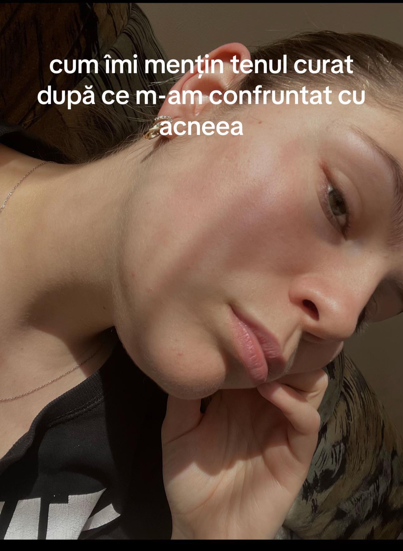 @IULIA🐞