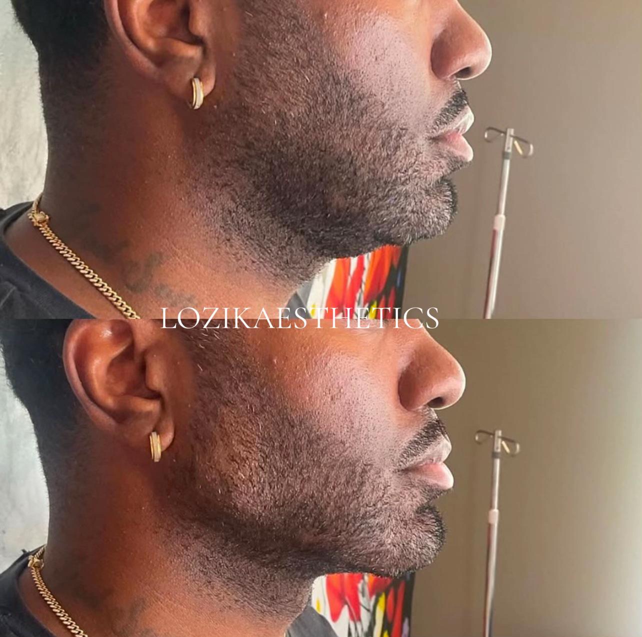 @LOZIK AESTHETICS | SPA IN AJAH