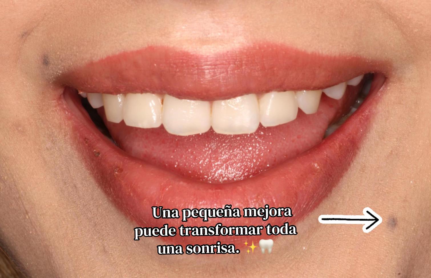 @Cava Cl&iacute;nica Dental 🦷