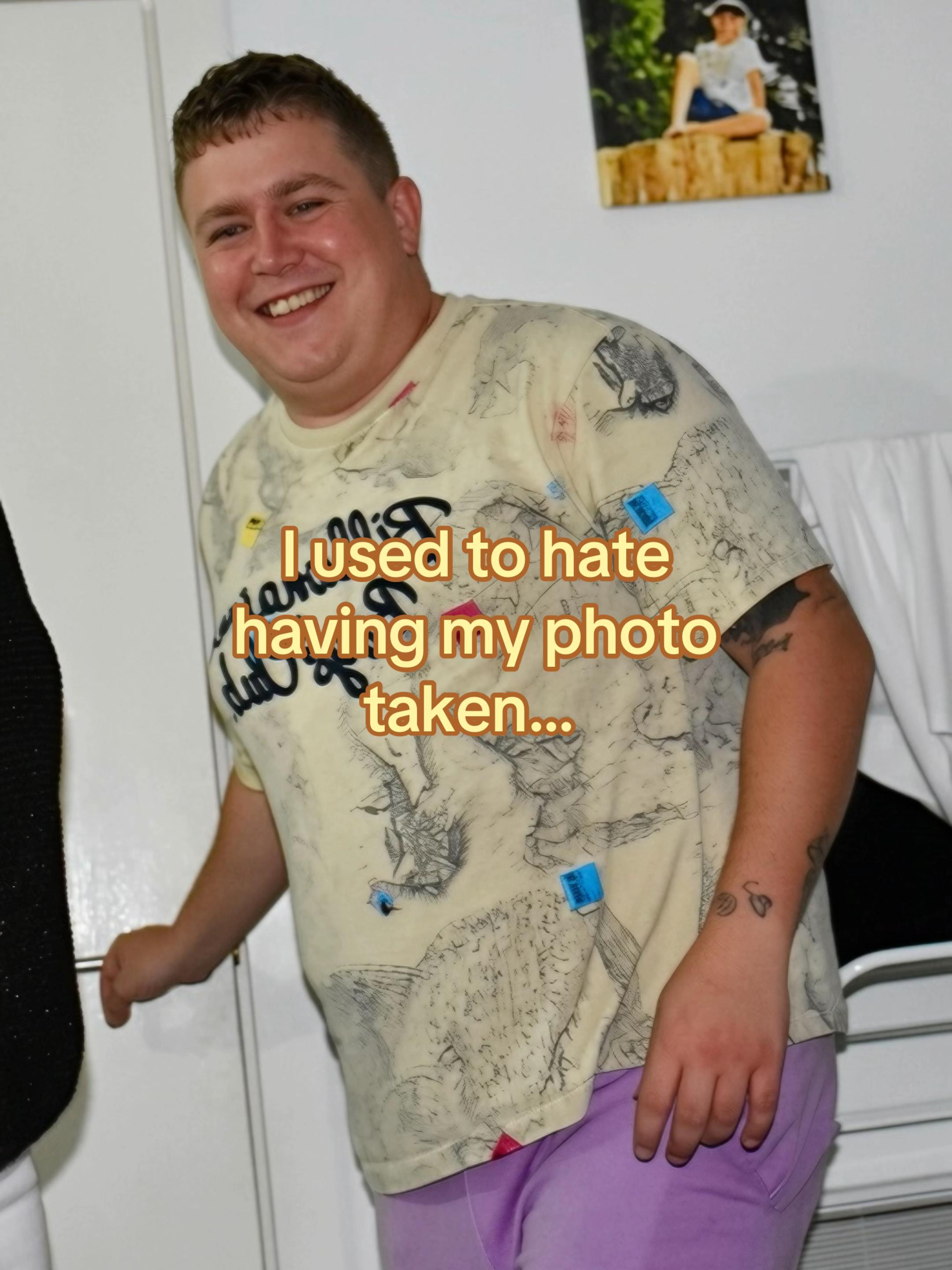 @KD | Life After Weight Loss