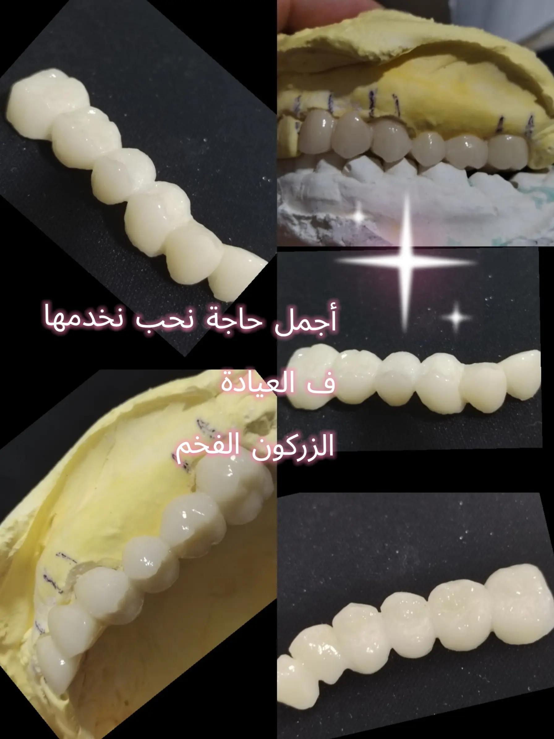 @Dr HASSOUN02 طبيبة الاسنان شلف
