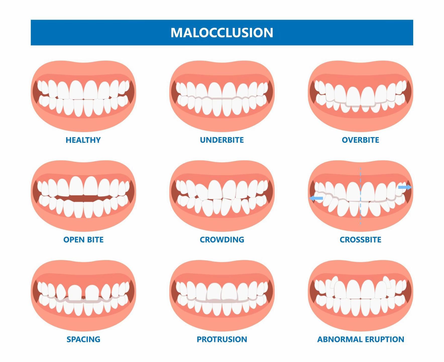 @Braces Haven Nairobi Dental
