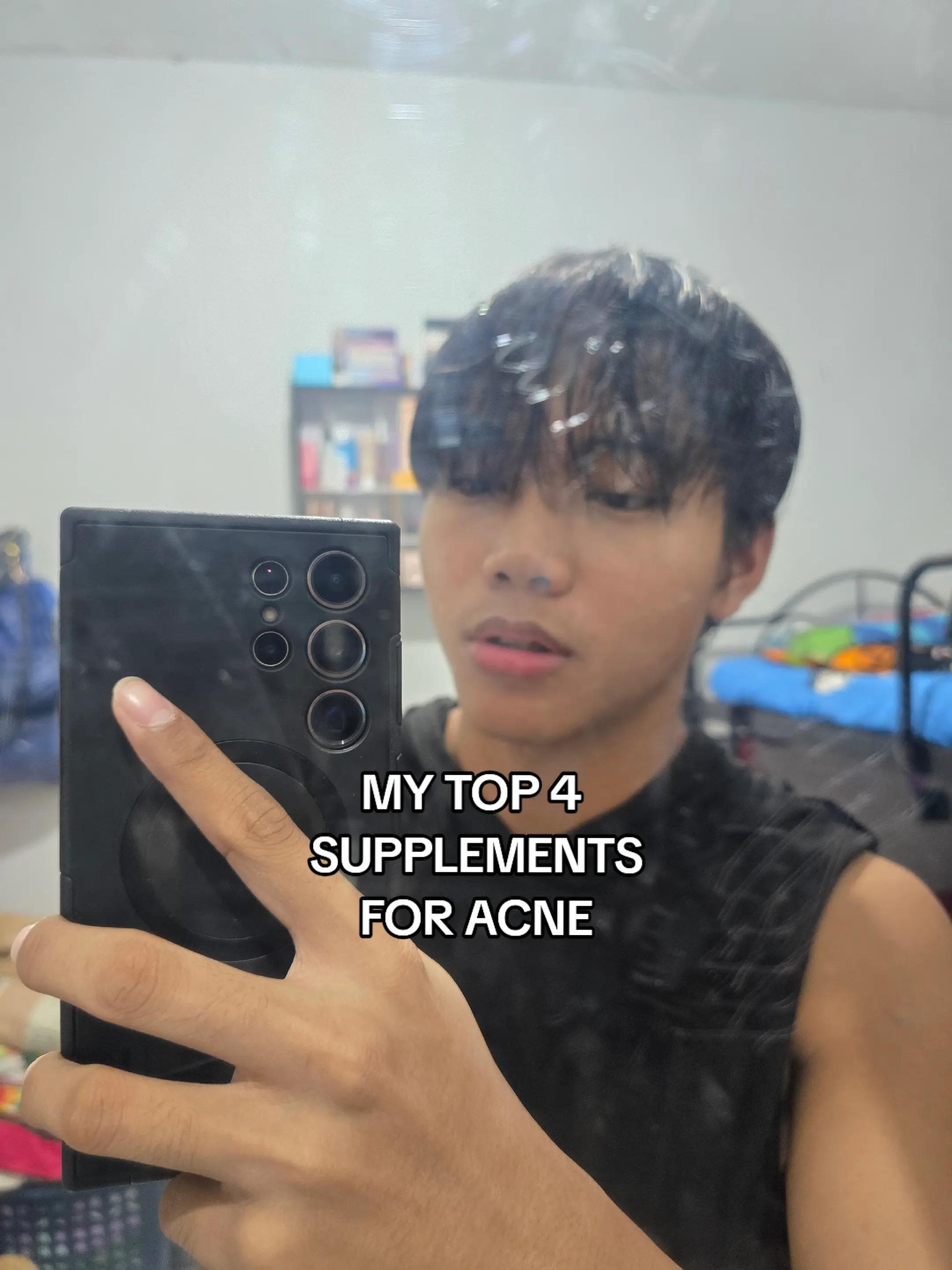@TOP J