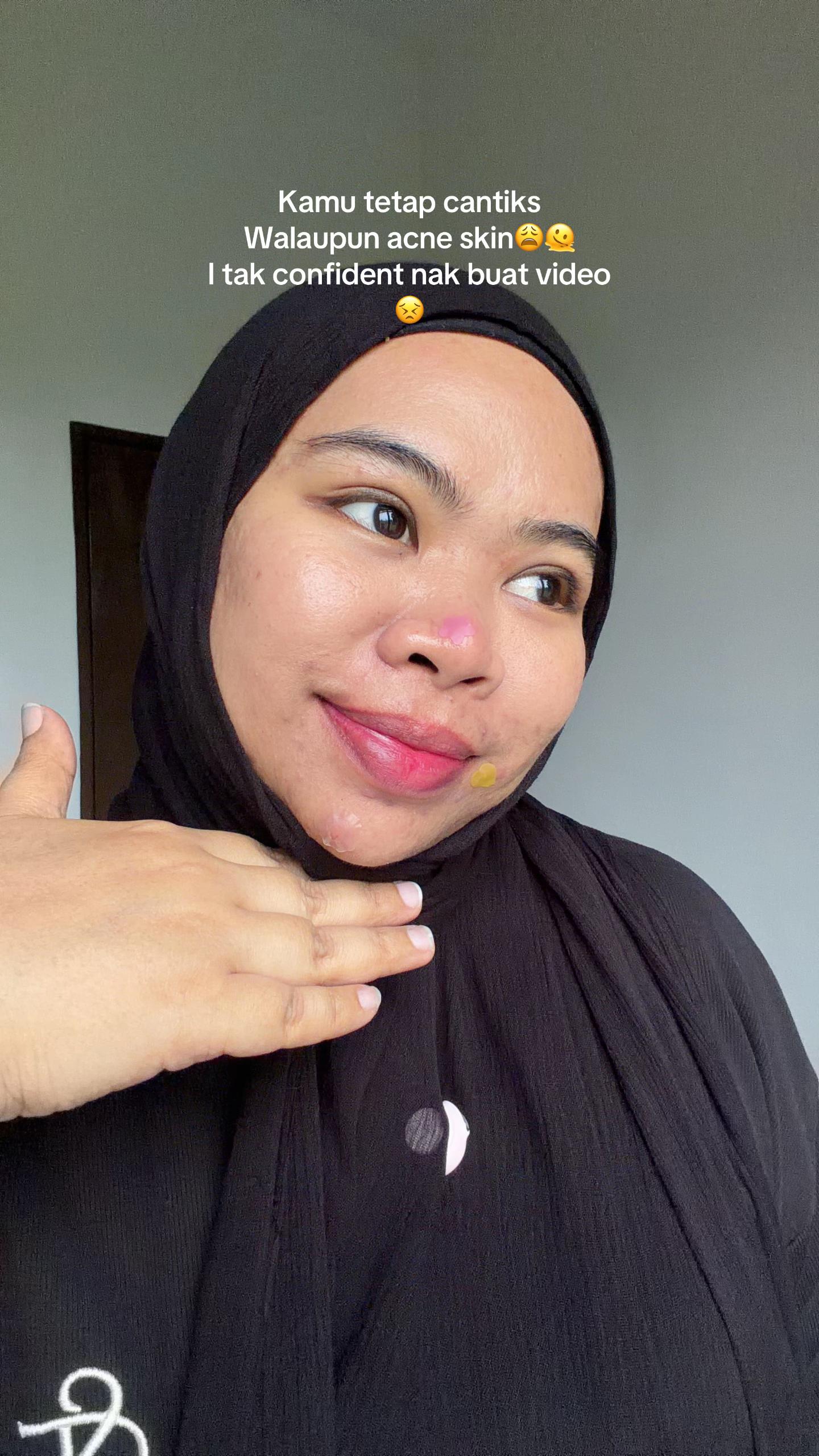 @Jieyhaa