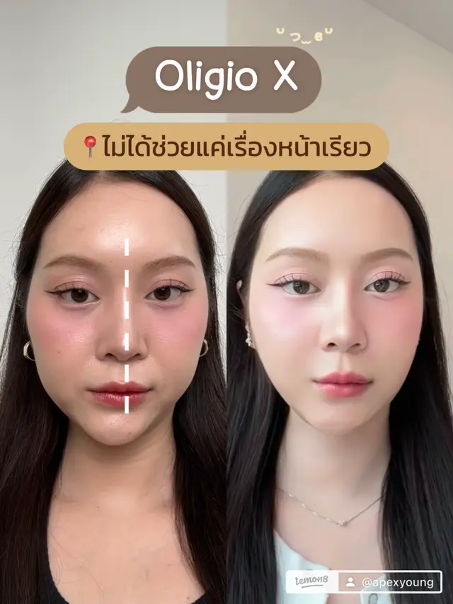 @APEXYOUNGCLINIC