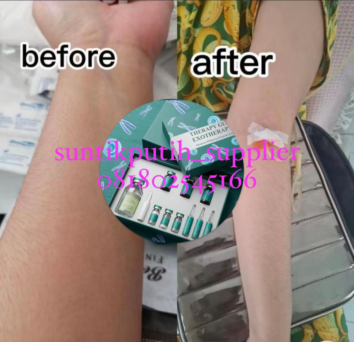 @dunia_suntikputih2
