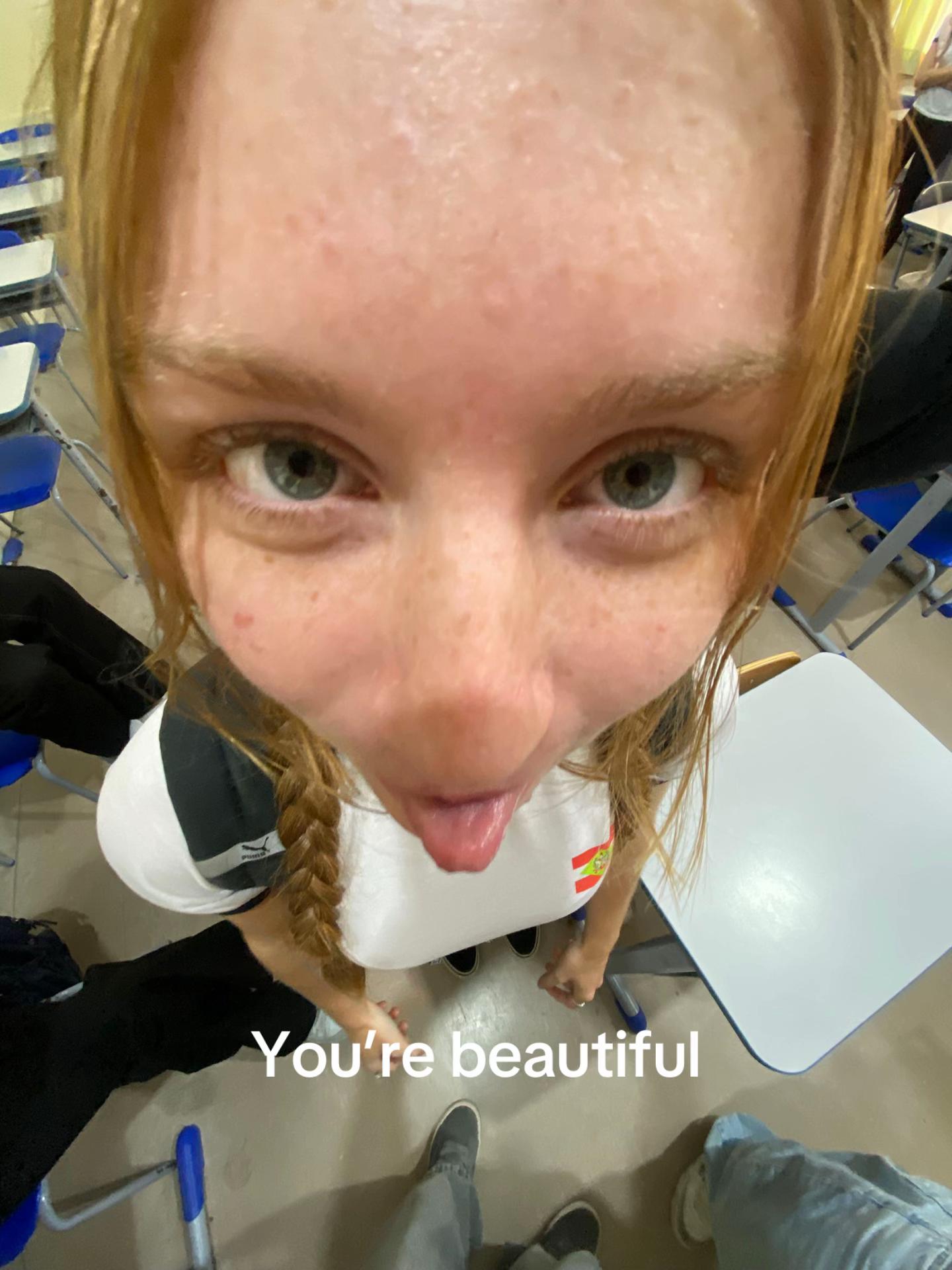 @lorg315
