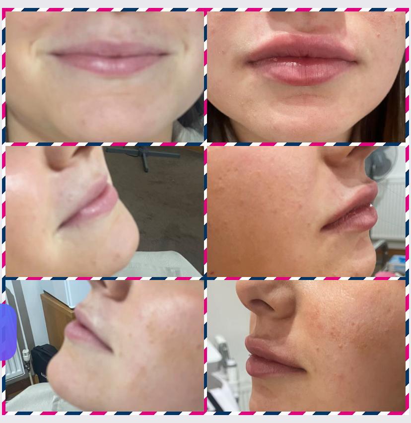 @Diamond Aesthetics Barnsley